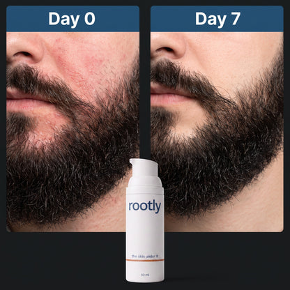 Beard Skin Recovery Cream