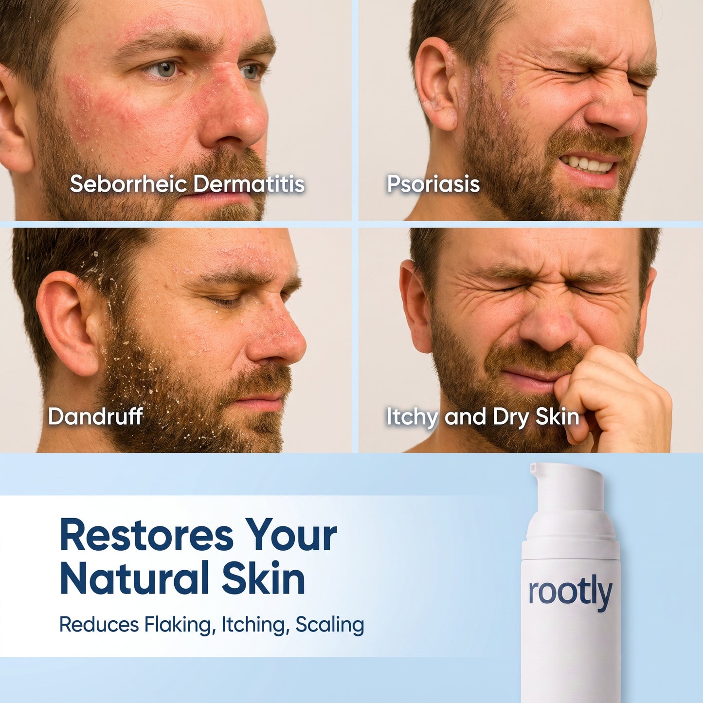 Beard Skin Recovery Cream